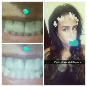 L.A SMILE CLINIC take home teeth whitening kit